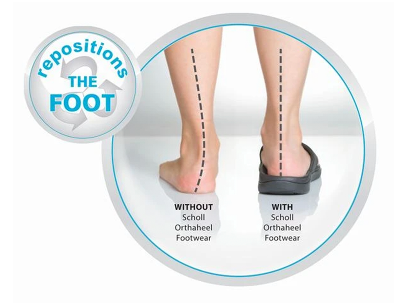 Orthaheel 2025 sonoma thongs